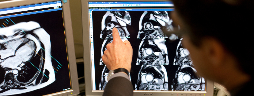 Doctor pointing at brain scans