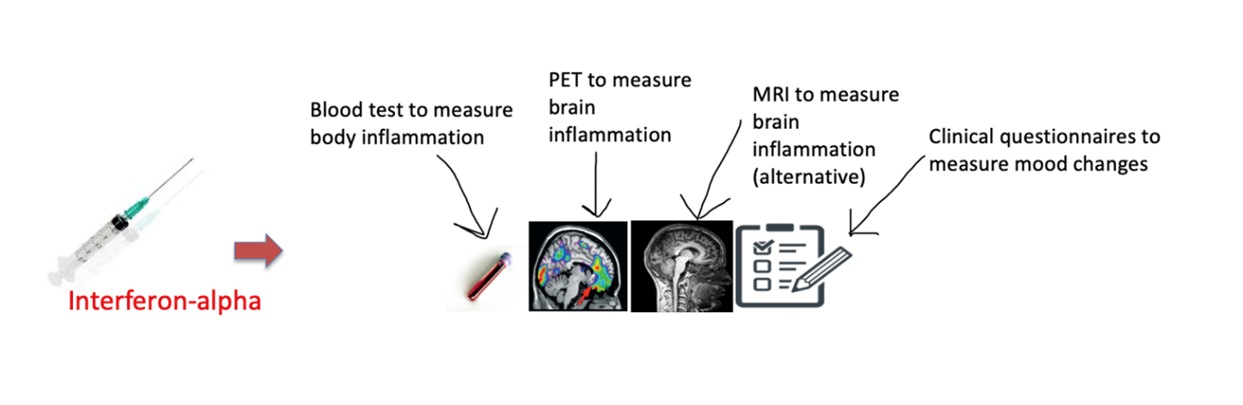 MRI inflammation scan