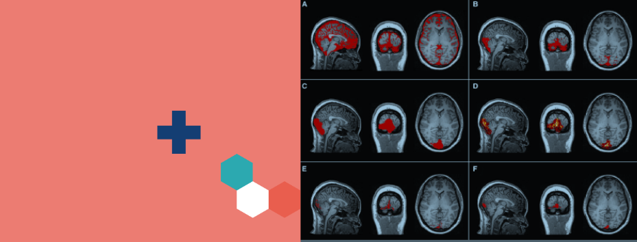 brain scans